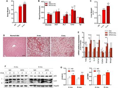 Lipophagy Impairment Is Associated With Disease Progression in NAFLD